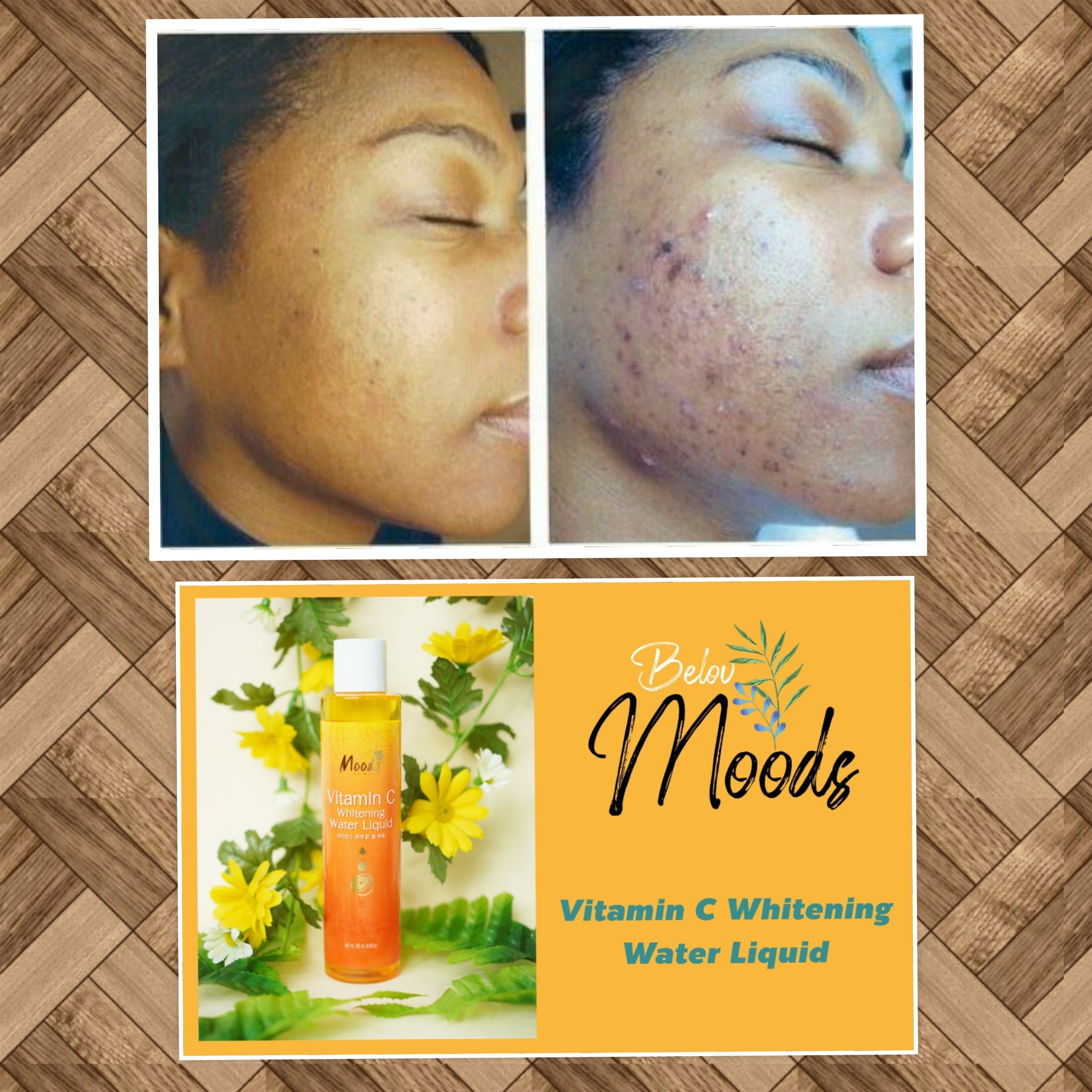 serum Vitamine c serum Vitamine c