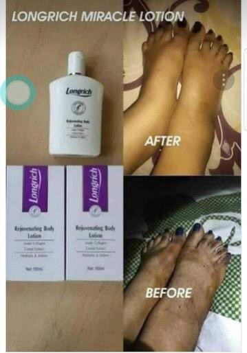 Lotion miracle