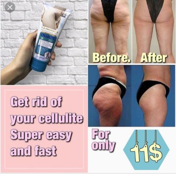 Cellulite gel cream